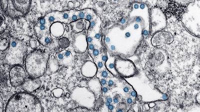 Transmission electron microscopic image of an isolate from the first U.S. case of COVID-19, formerly known as 2019-nCoV. The spherical viral particles, colorized blue, contain cross-sections through the viral genome, seen as black dots. (coronavirus)