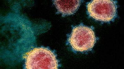 Transmission electron microscope image shows SARS-CoV-2-also known as 2019-nCoV, the virus that causes COVID-19 (coronavirus) - isolated from a patient in the U.S. Virus particles are shown emerging from the surface of cells cultured in the lab. Spikes...