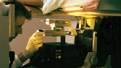 stereotatic biopsy