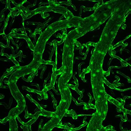 brain endothelial cells; blood-brain barrier