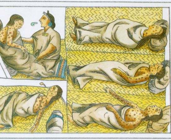 smallpox
